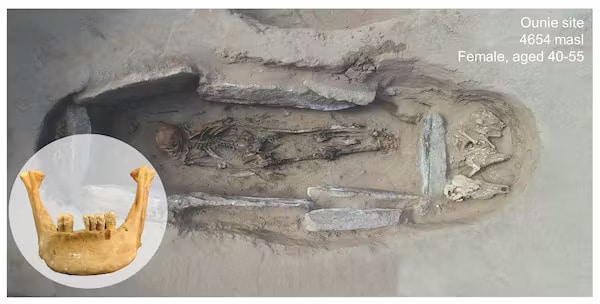 One of the individuals we studied was a woman, aged 40-55, buried at the Ounie site. Hers were the highest altitude (4654 masl) remains studied, dated to around 601-758 CE. Li Tang and Zujun Chen, Author provided